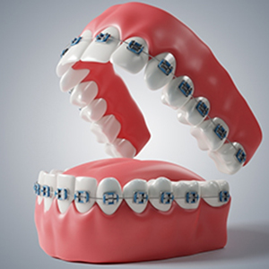 orthodontic in Karimnagar