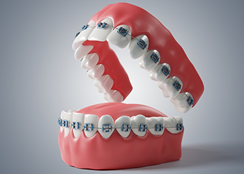 Orthodontic in Karimnagar